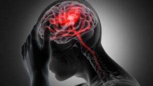What should I do after a traumatic brain injury?