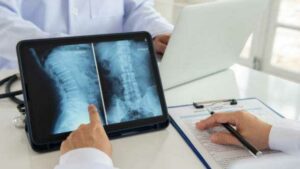 Is the Most Serious Type of Spinal Cord Injury?