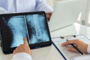 Is the Most Serious Type of Spinal Cord Injury?